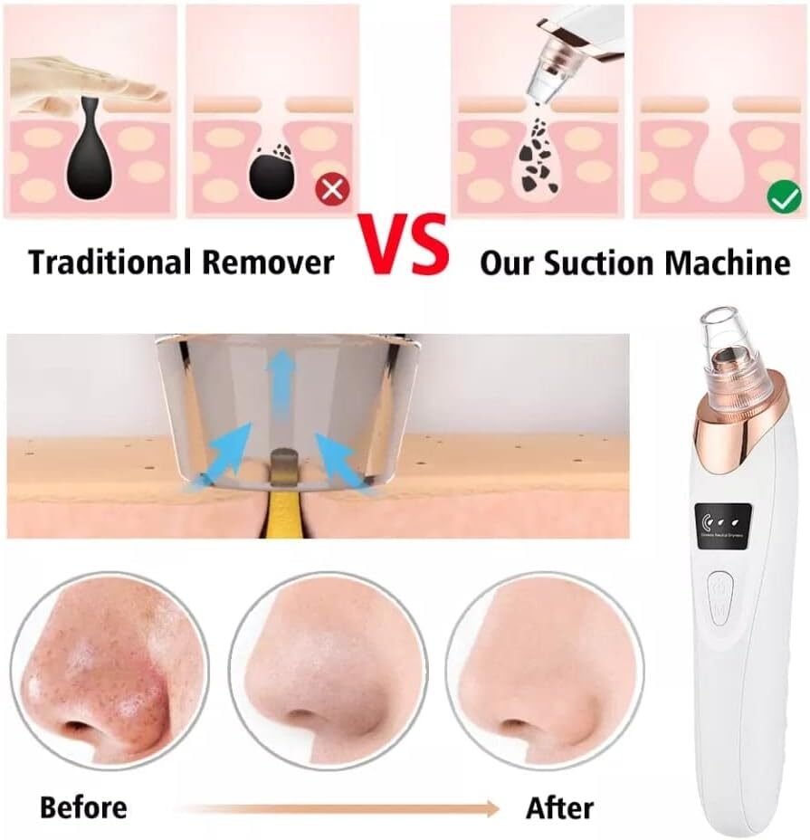 Electric Blackhead Remover Vacuum Acne Cleaner Black Spots Removal Facial Deep Cleansing Pore Cleaner Machine Skin Care Tools